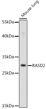 RASD2 Rabbit pAb