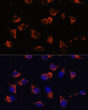 CA19-9 Mouse mAb