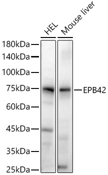 EPB42 Rabbit pAb