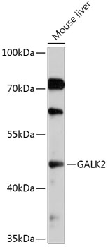 GALK2 Rabbit pAb