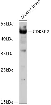 CDK5R2 Rabbit pAb