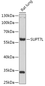 SUPT7L Rabbit pAb