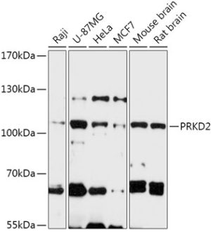 PRKD2 Rabbit pAb