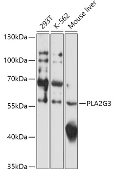 PLA2G3 Rabbit pAb