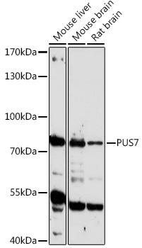 PUS7 Rabbit pAb