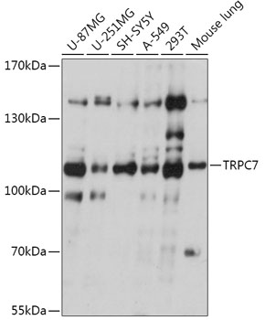 TRPC7 Rabbit pAb