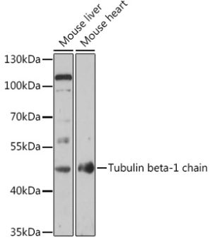 Tubulin beta-1 chain Rabbit pAb