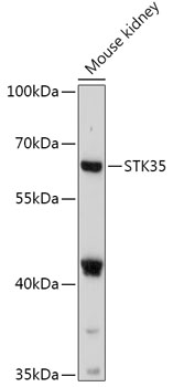 STK35 Rabbit pAb