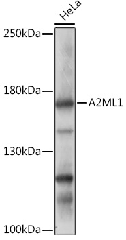 A2ML1 Rabbit pAb