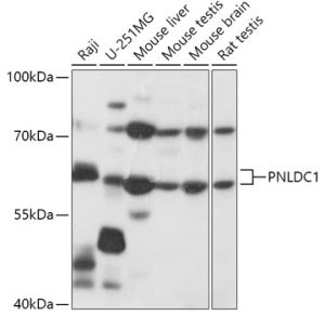 PNLDC1 Rabbit pAb
