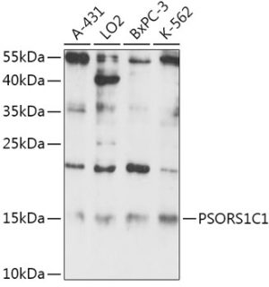 PSORS1C1 Rabbit pAb