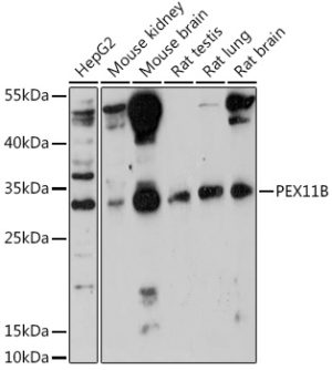 PEX11B Rabbit pAb