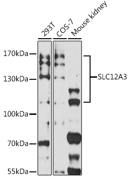 SLC12A3 Rabbit pAb