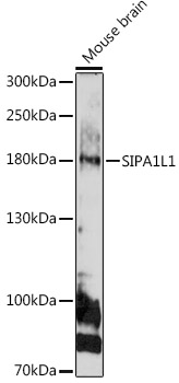 SIPA1L1 Rabbit pAb