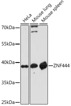 ZNF444 Rabbit pAb