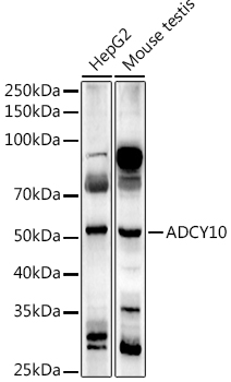 ADCY10 Rabbit pAb