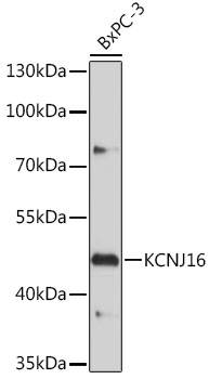 KCNJ16 Rabbit pAb