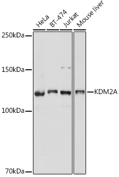 KDM2A Rabbit pAb