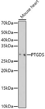 PTGDS Rabbit pAb