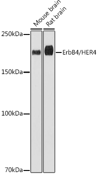 ErbB4/HER4 Rabbit mAb