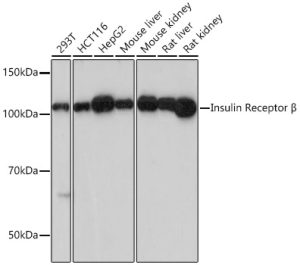 Insulin Receptor Rabbit mAb