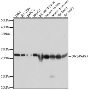 DJ-1/PARK7 Rabbit mAb