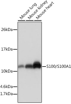 S100/S100A1 Rabbit mAb