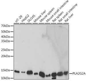 PLA2G2A Rabbit mAb