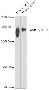 ANPRB/NRP2 Rabbit mAb