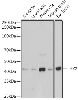 LHX2 Rabbit mAb