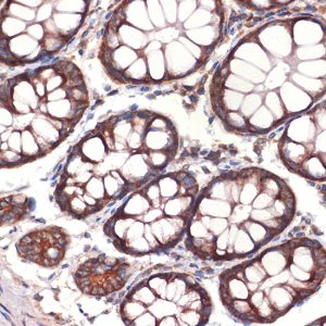 CC2D1A Rabbit mAb