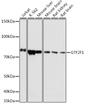 GTF2F1 Rabbit pAb