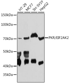 PKR/EIF2AK2 Rabbit mAb