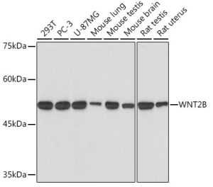 WNT2B Rabbit mAb
