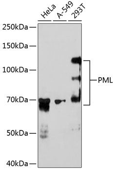 PML Rabbit mAb