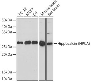 Hippocalcin (HPCA) Rabbit mAb