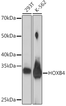 HOXB4 Rabbit mAb