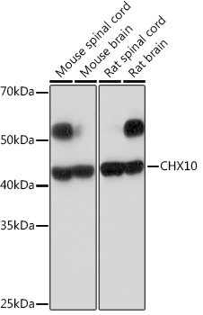 CHX10 Rabbit mAb