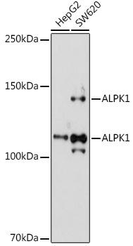 ALPK1 Rabbit pAb
