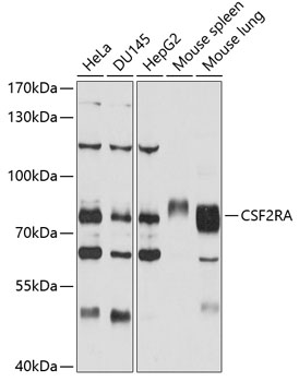 CSF2RA Rabbit pAb