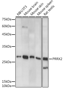 PRRX2 Rabbit pAb