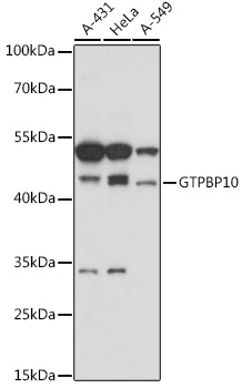 GTPBP10 Rabbit pAb