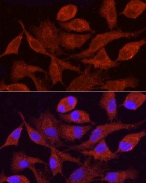 CYP4F11 Rabbit pAb