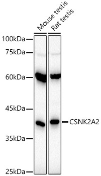 CSNK2A2 Rabbit mAb