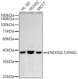 ENDOGL1 / ENGL Rabbit mAb