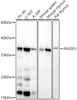 RASSF2 Rabbit mAb
