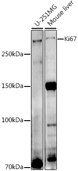 Ki67 Rabbit pAb