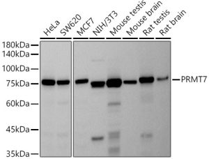 PRMT7 Rabbit mAb