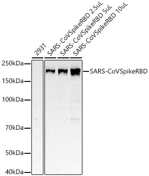 SARS-CoV Spike RBD Rabbit mAb
