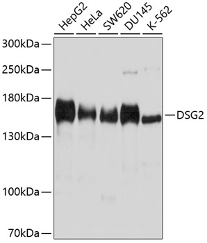 DSG2 Rabbit pAb